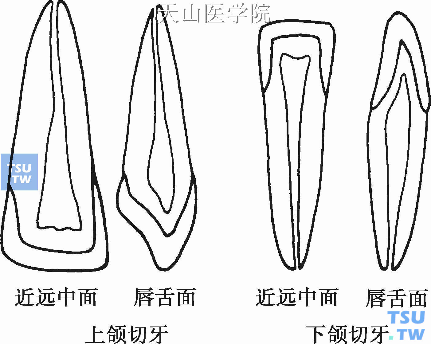 牙髓腔解剖：前牙、磨牙、乳牙髓腔 - 口腔医学 - 天山医学院