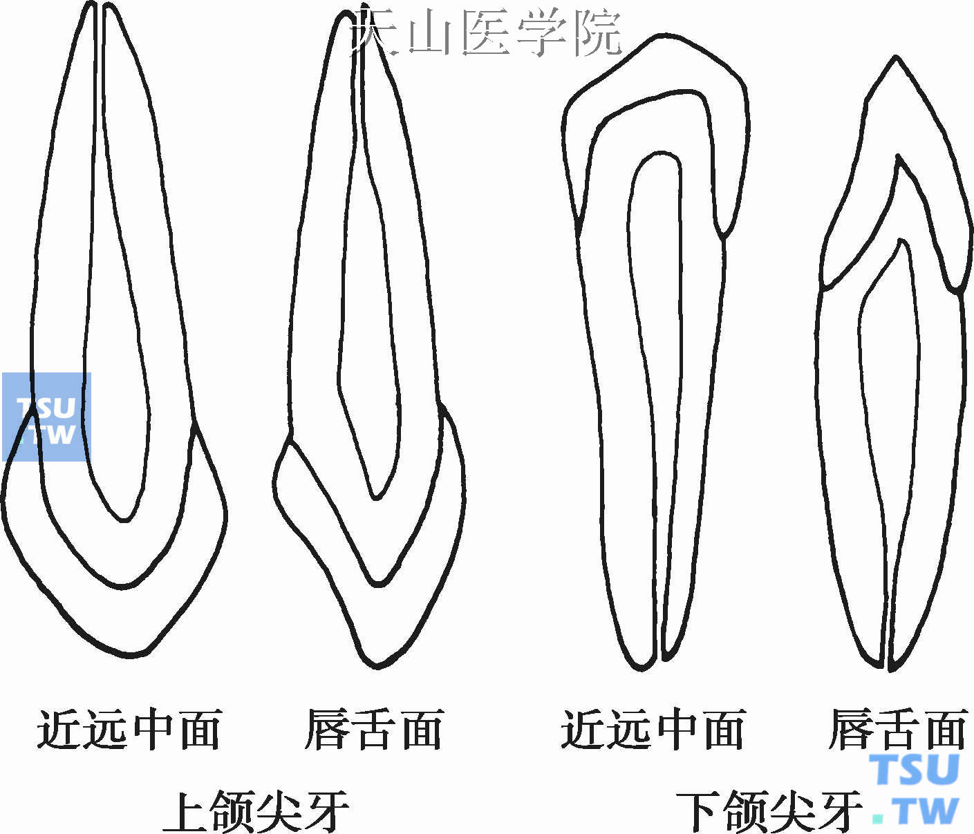 上、下颌尖牙髓腔形态