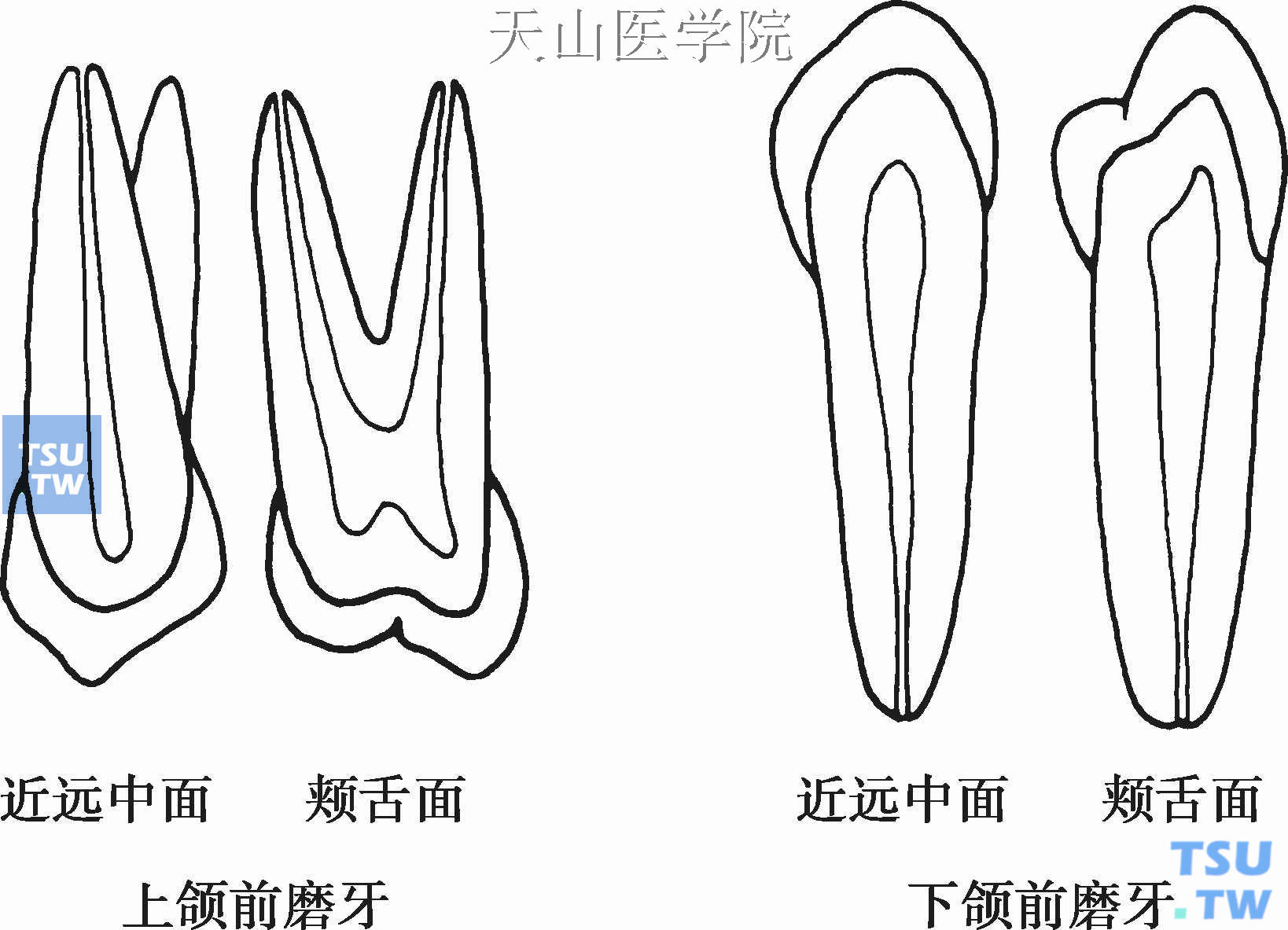 前磨牙的髓腔形态