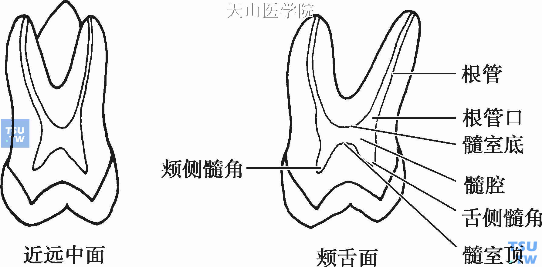 上颌磨牙髓腔形态