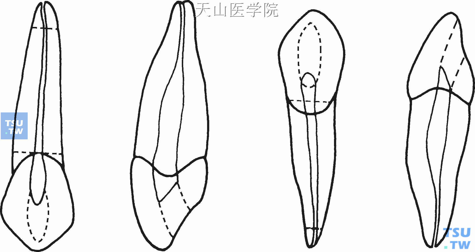 上、下颌尖牙根管形态