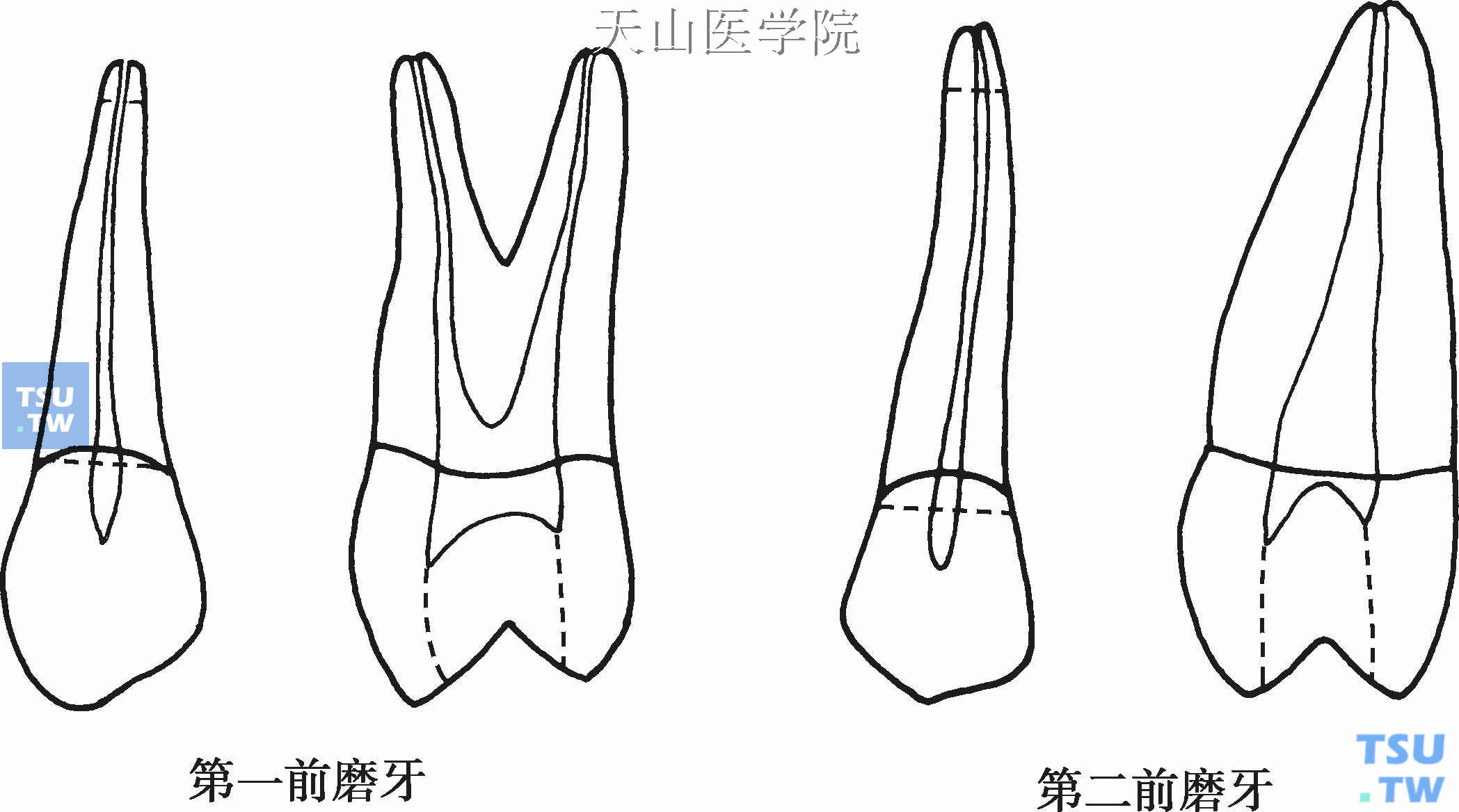 上颌前磨牙根管形态