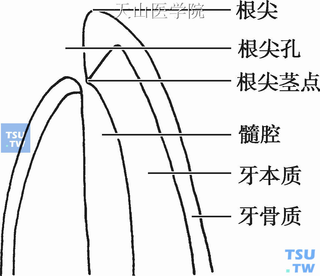 根尖孔解剖