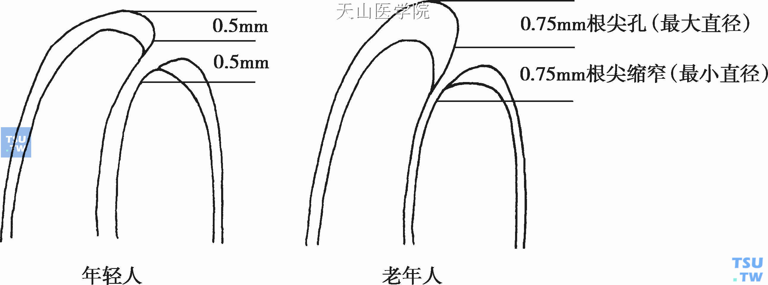 根尖孔的增龄性变化