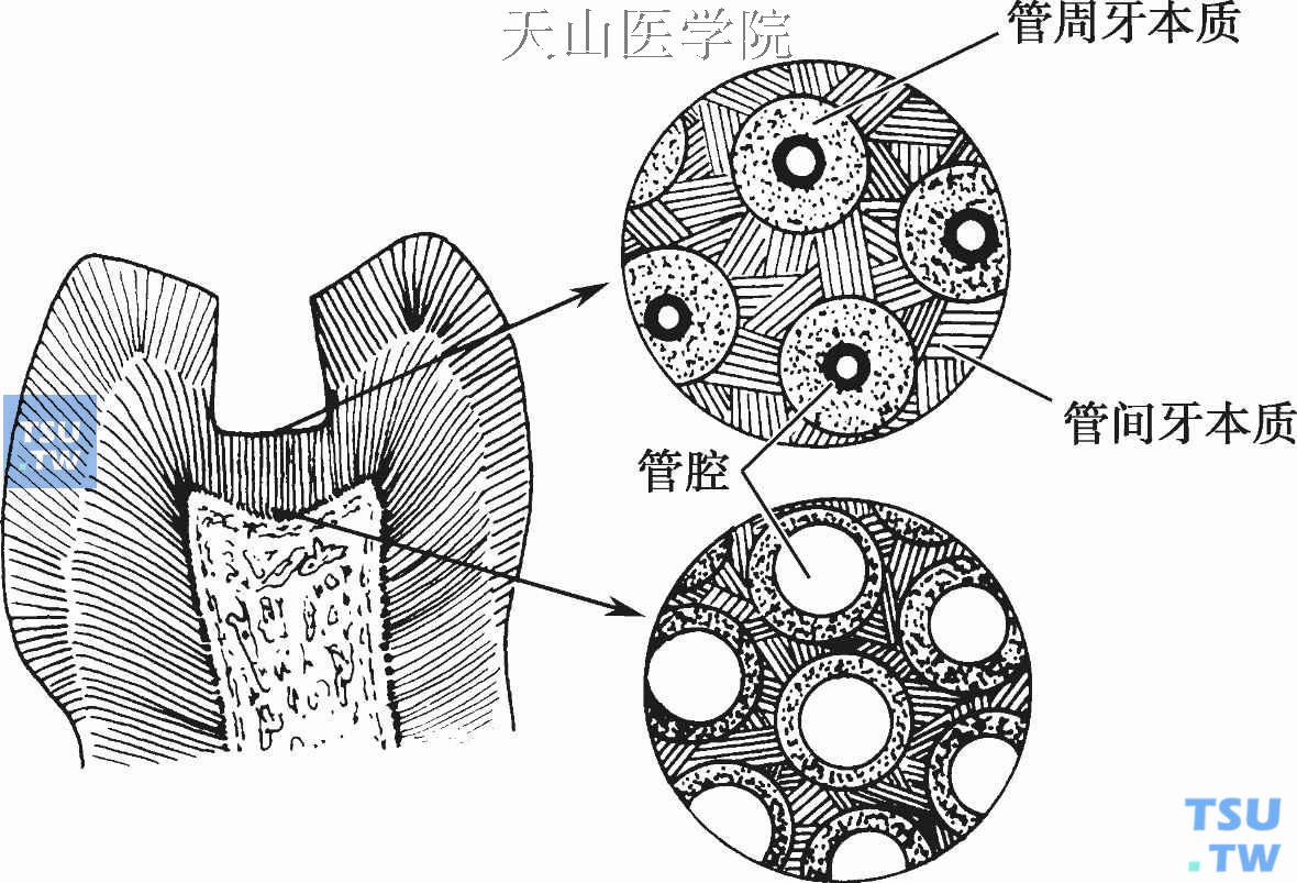 牙本质