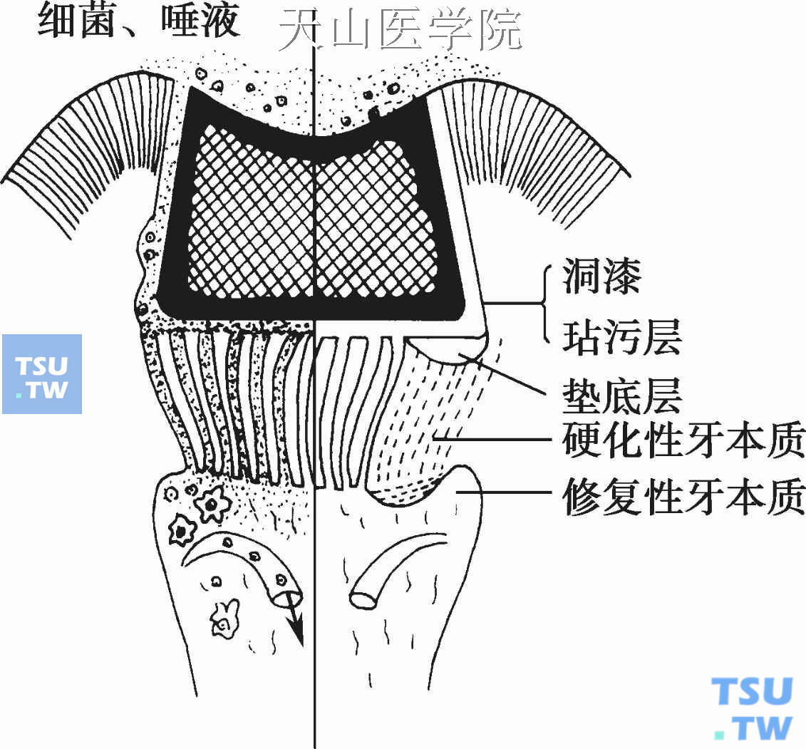 牙本质的通透性