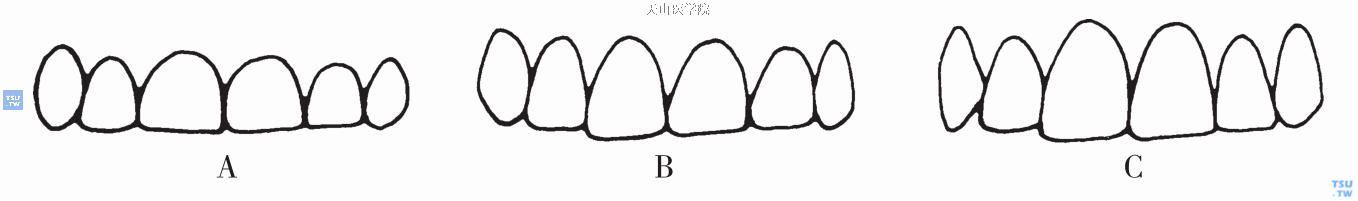 上中切牙的长宽比例美