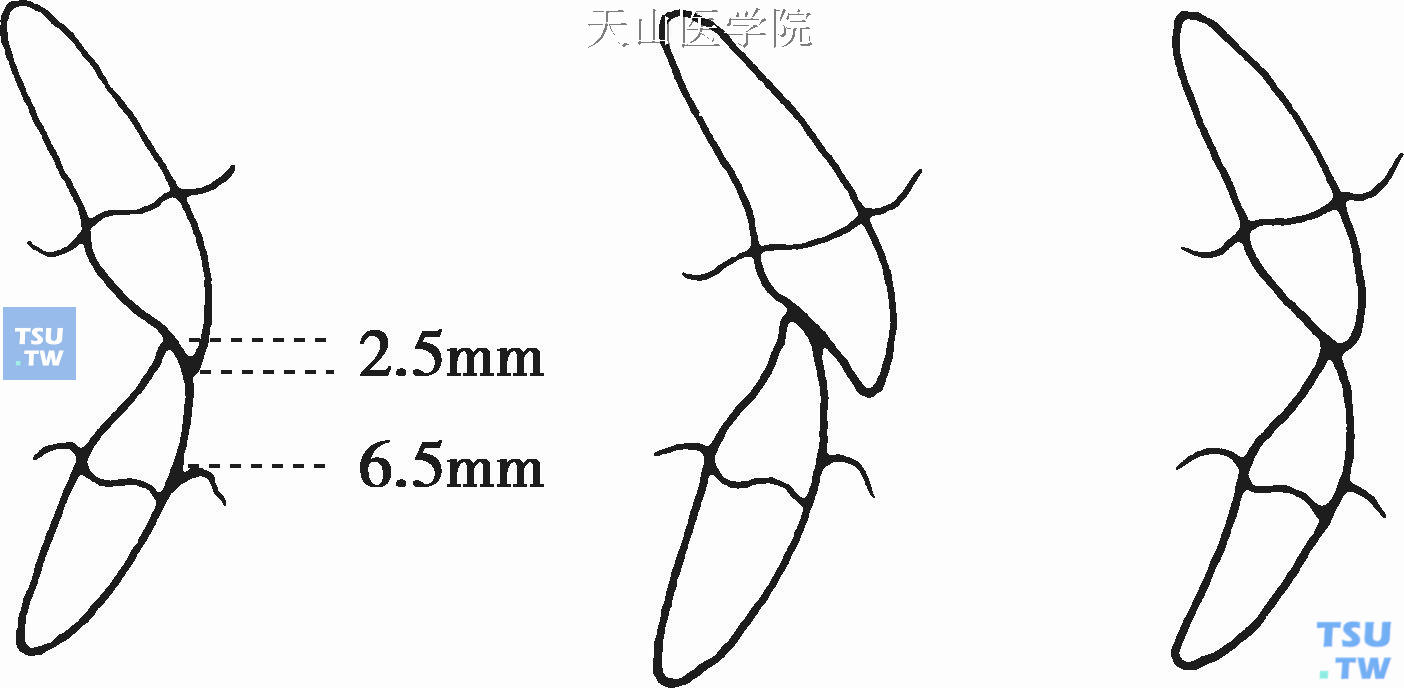 前牙覆 关系比例美