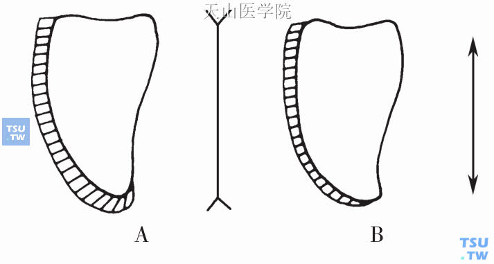 利用长短错觉原理使牙冠“变长”或“缩短”