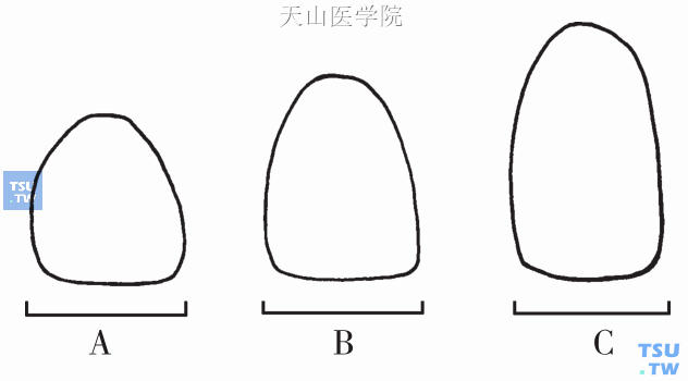 对比错觉