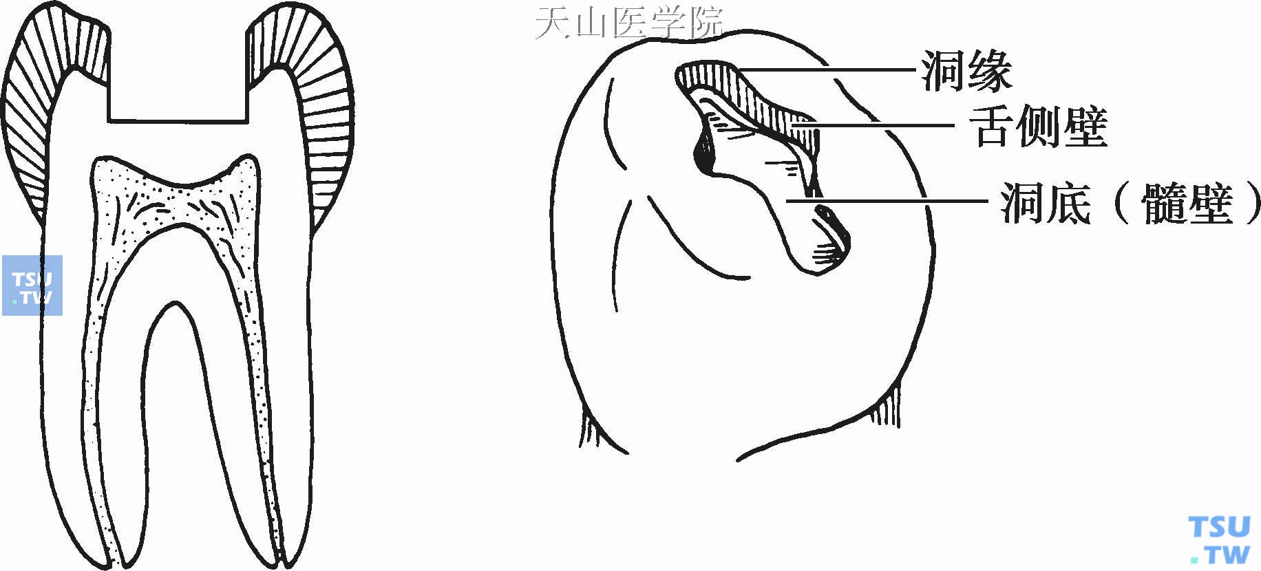 箱状结构