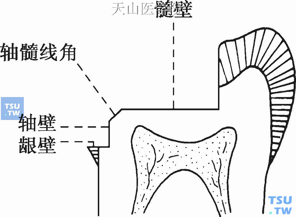 梯形结构