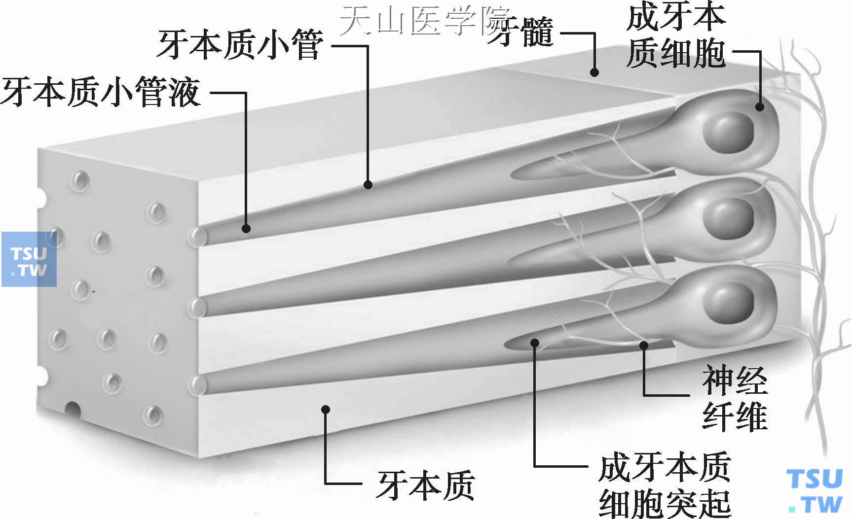 成牙本质细胞被吸入牙本质小管示意图