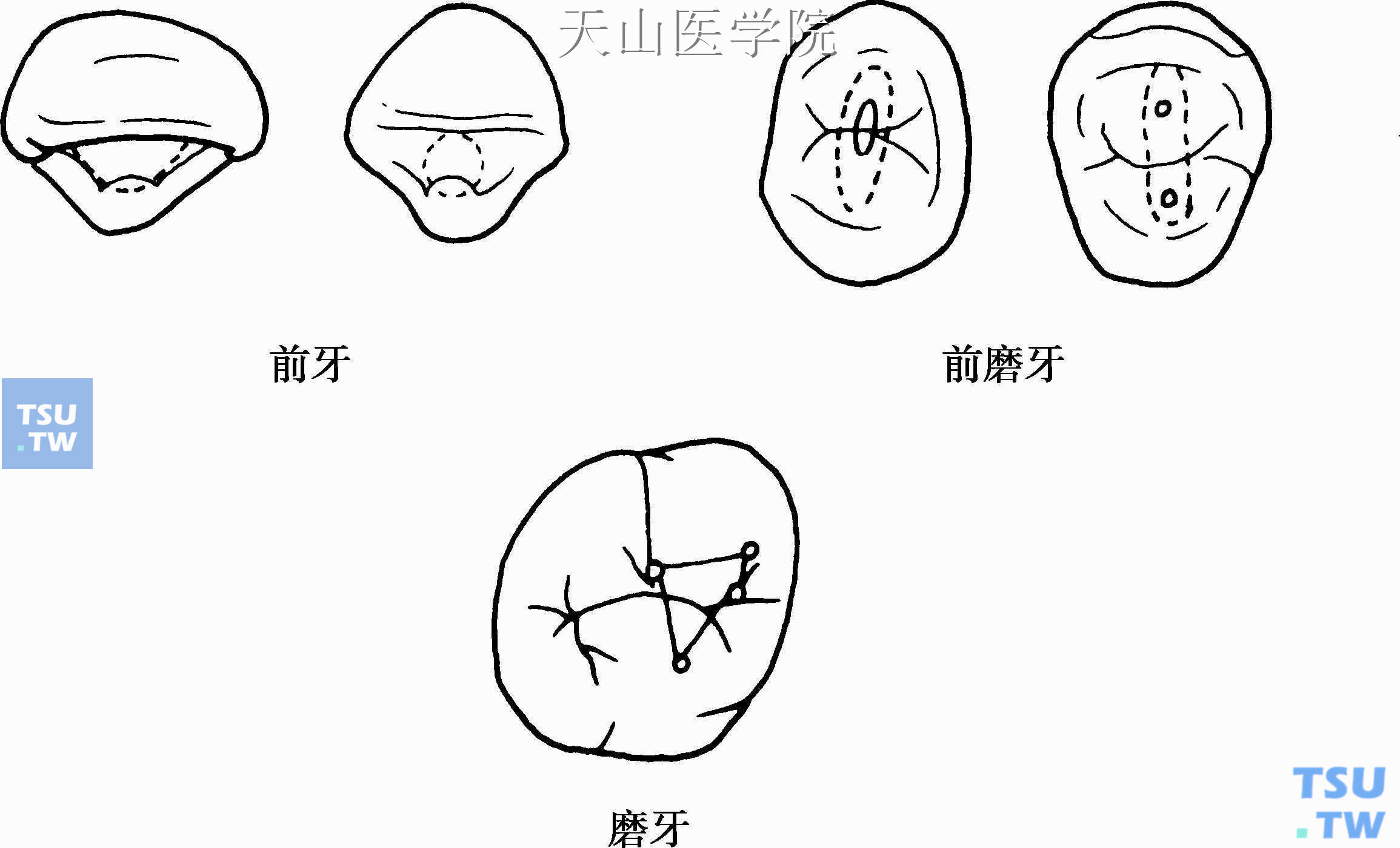 不同牙齿的开髓位置