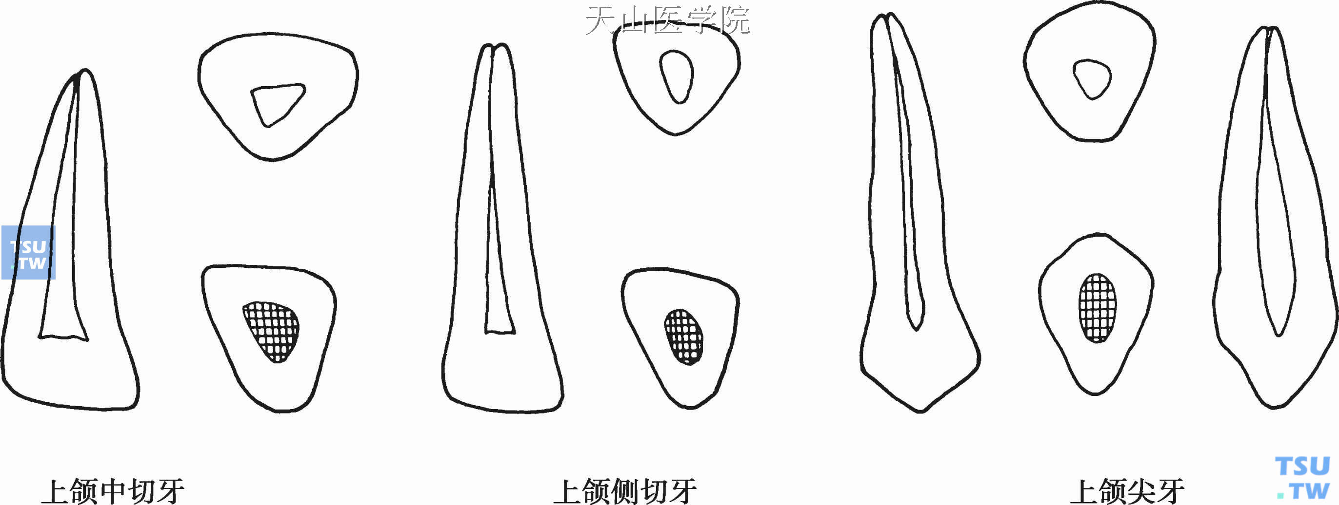 上颌侧切牙的解剖图图片