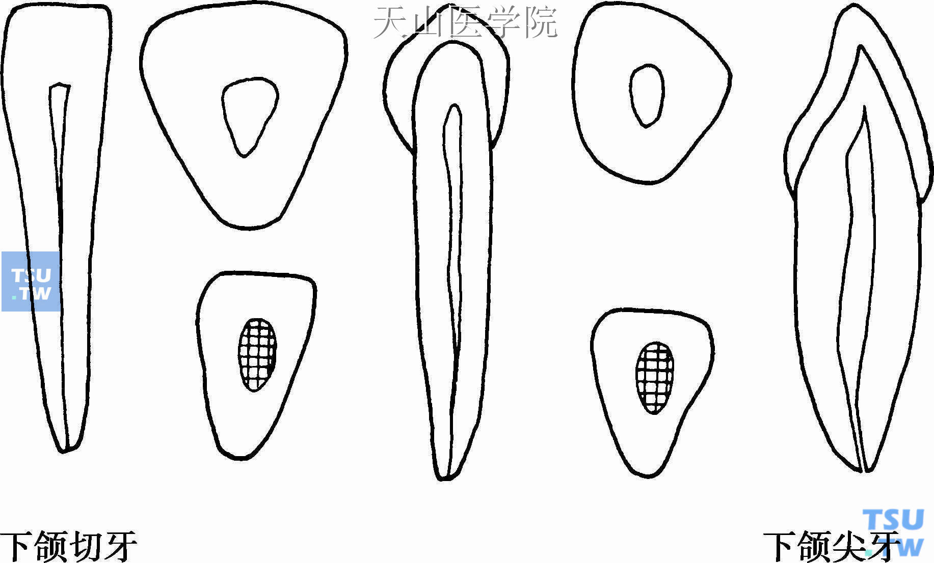 下颌前牙髓腔形态及开髓洞形