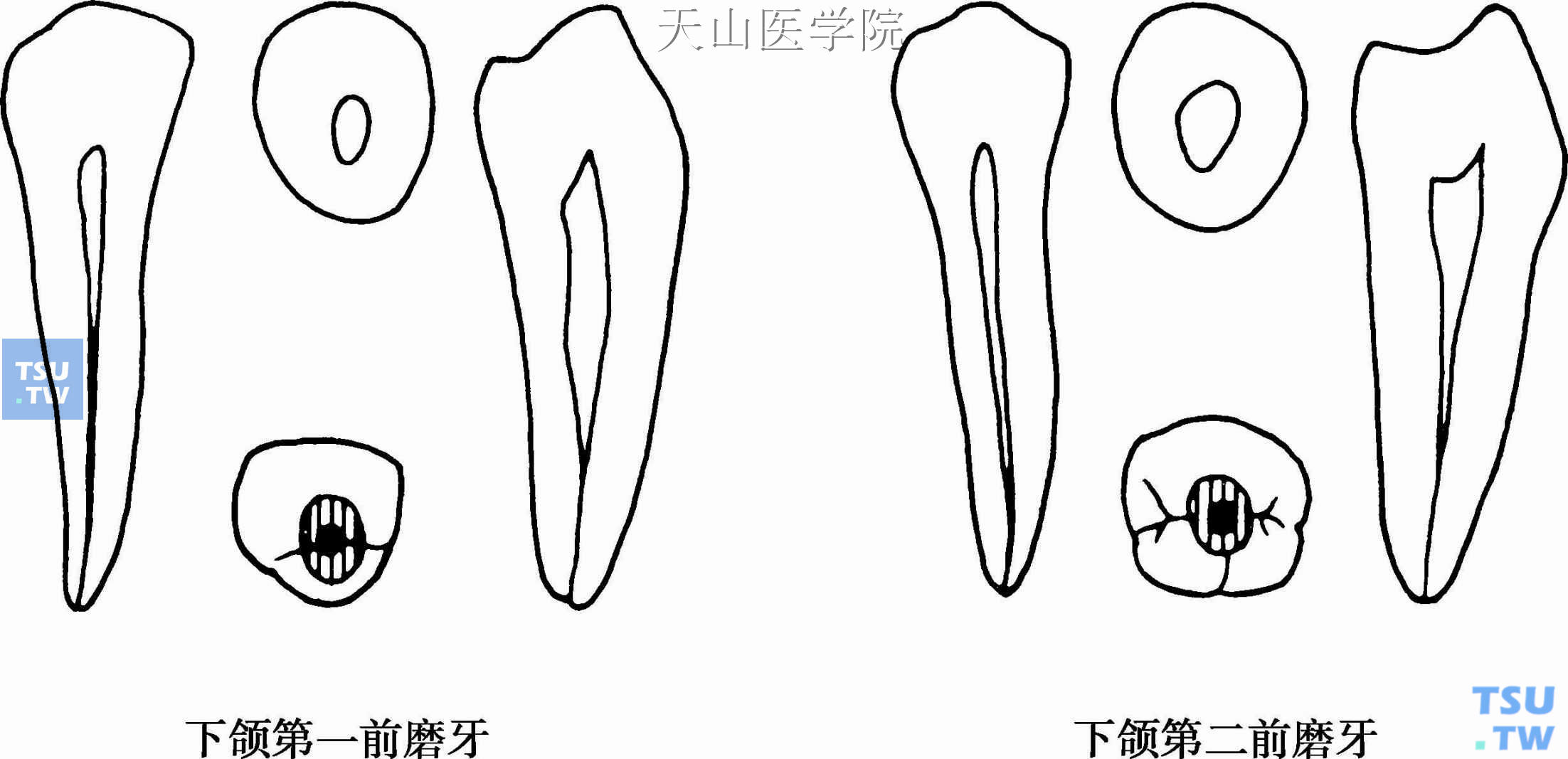 下颌前磨牙髓腔形态及开髓洞形