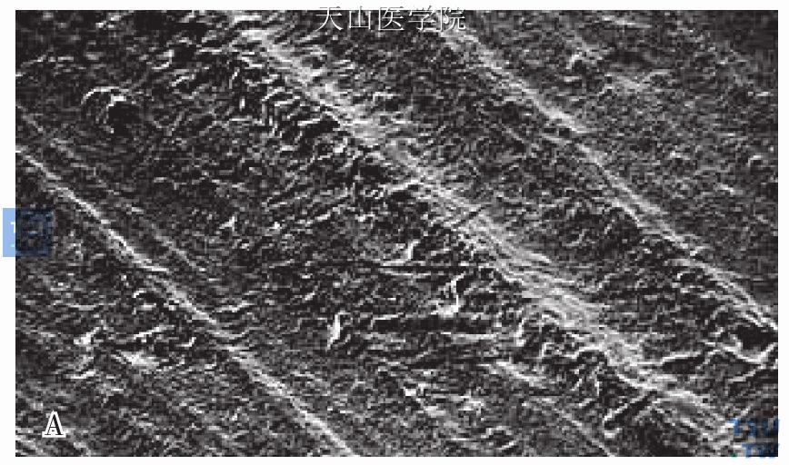 牙本质电镜图图片