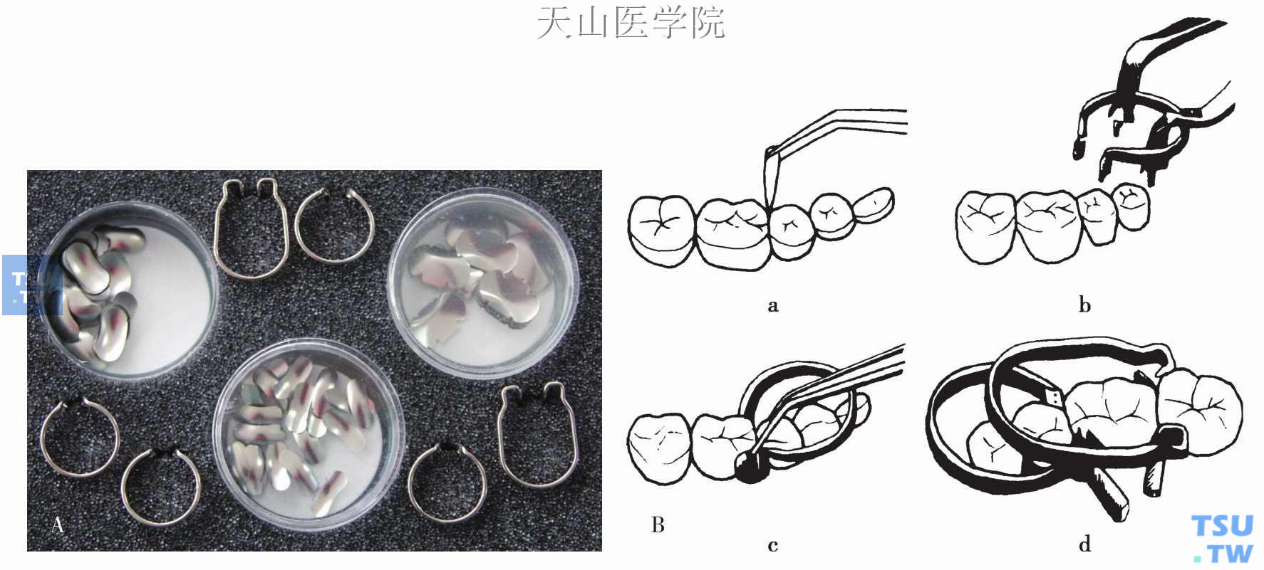 帕拉垫系统