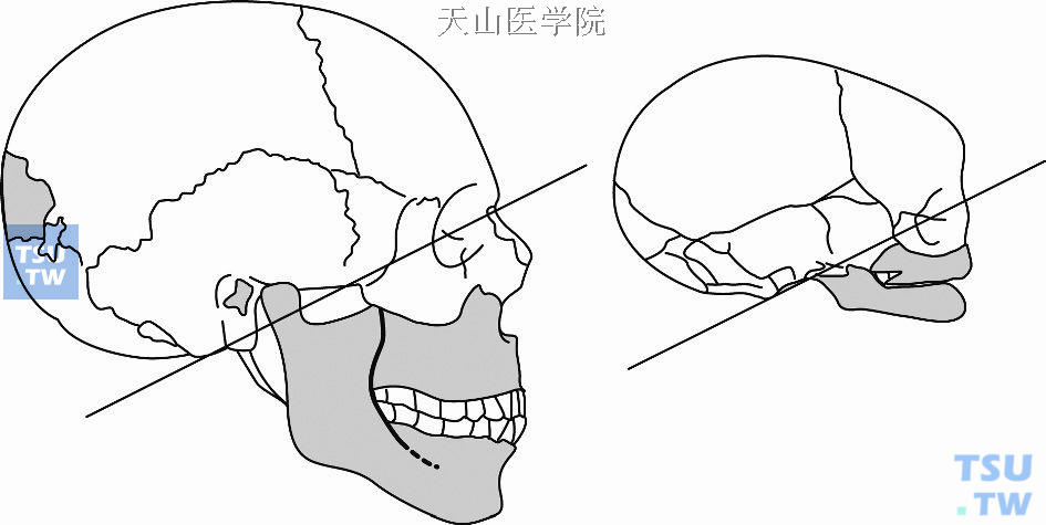 出生后儿童与成人颅面图