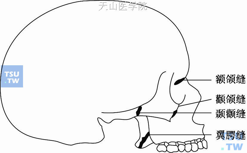 上颌骨骨缝位置图