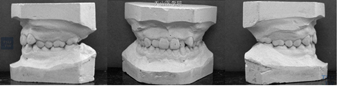 记存模型