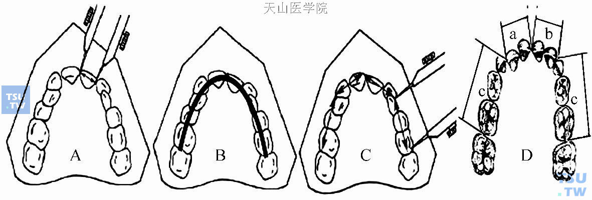 牙弓长度测量