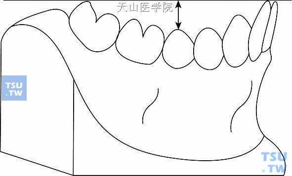 测量Spee的曲线高度