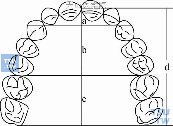 牙弓长度的测量：a. 牙弓前段长度；b. 牙弓中段长度；c. 牙弓后段长度