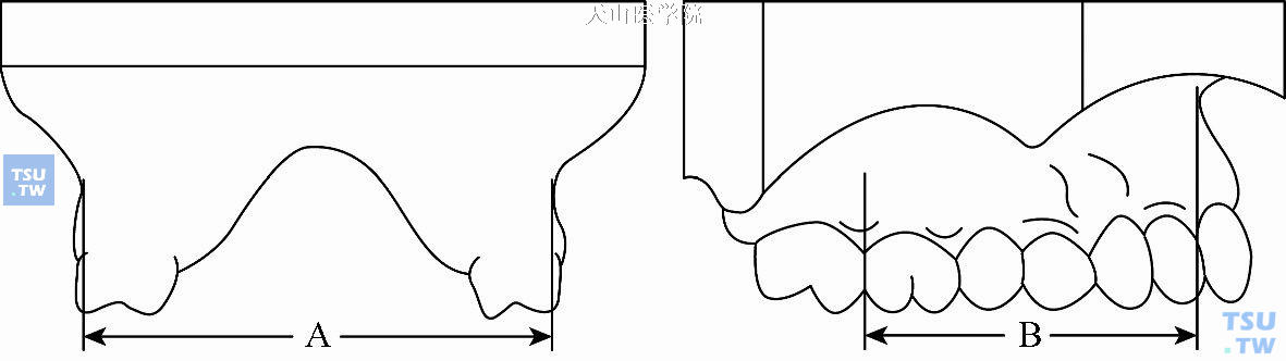 基骨弓的宽度和长度：A. 基骨弓宽度；B. 基骨弓长度
