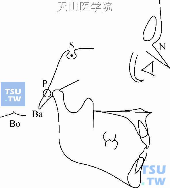 常用颅部标志点：S：蝶鞍点；N：鼻根点；P：耳点；Bo：Bolton点；Ba：颅底点
