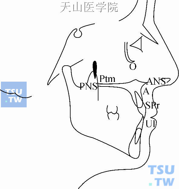 常用上颌标志点：O：眶点；Ptm：翼上颌裂点；ANS：前鼻棘点；PNS：后鼻棘点；A：上齿槽座点；SPr：上齿槽缘点；UI：上中切牙点