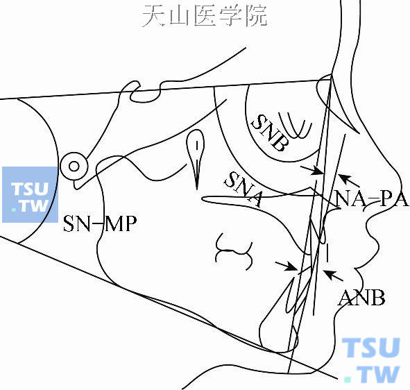 上下颌骨的常用测量项目（一）