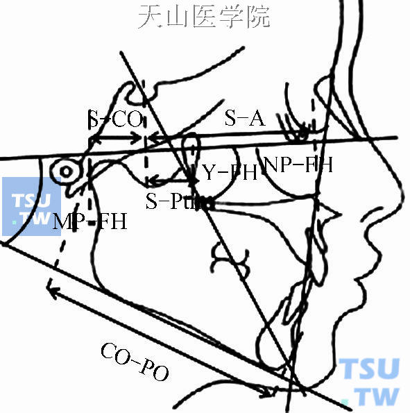 上下颌骨的常用测量项目（二）