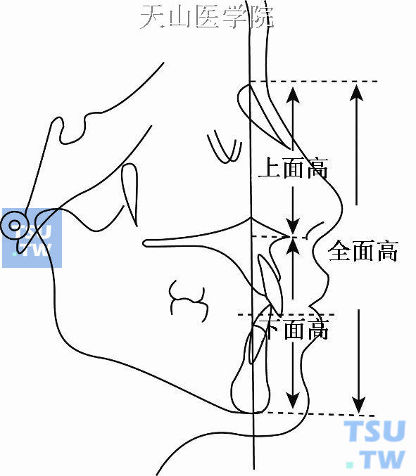 面部高度测量项目