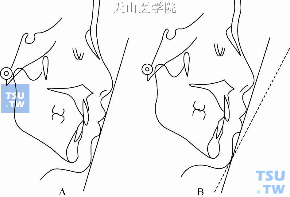 审美线、H线和Z线