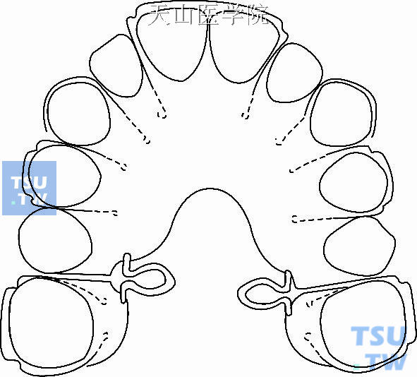 口腔正畸常用器械图解图片
