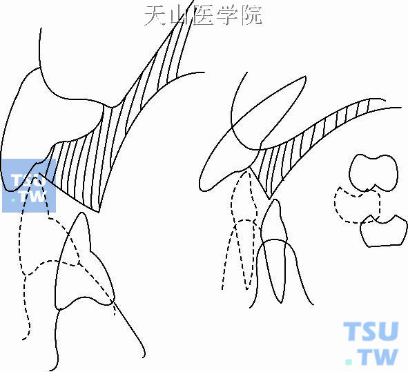 平面与斜面导板(图片)图片