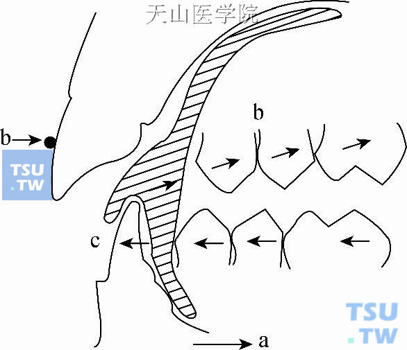 肌激动器矫治原理