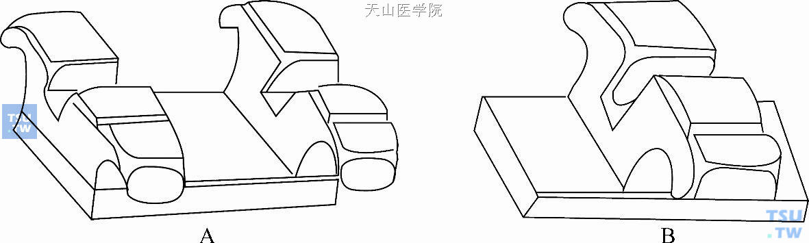 单、双翼方丝弓托槽