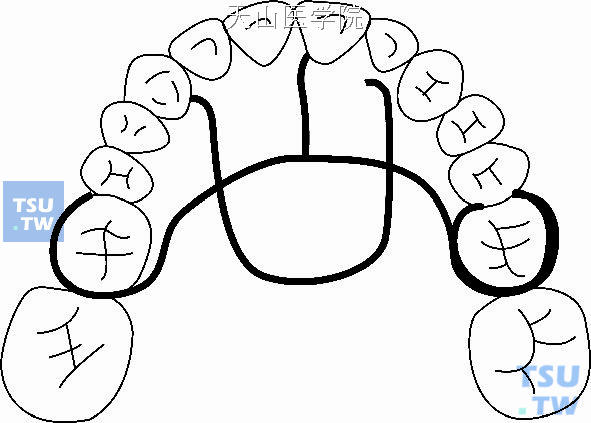 错牙合畸形的阻断矫治