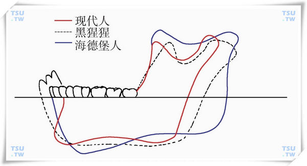 智齿阻生原因和智齿的危害