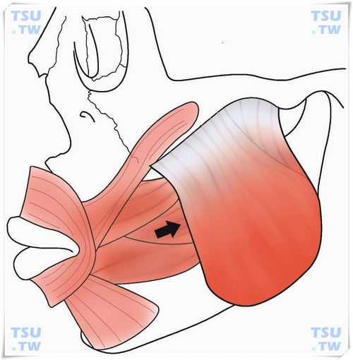  颊肌间隙解剖位置