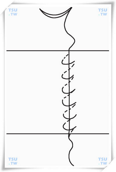  连续缝合示意图