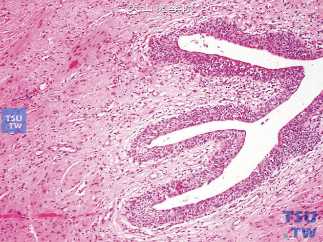 正常膀胱黏膜，形成不规则的皱襞，被覆尿路上皮细胞