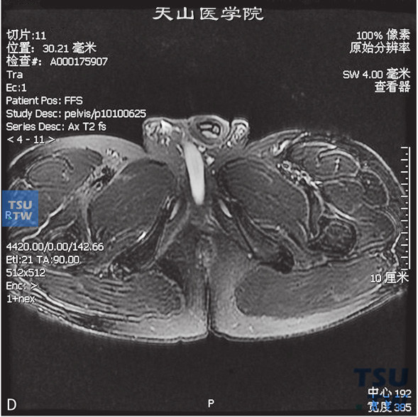 尿道的正常组织结构