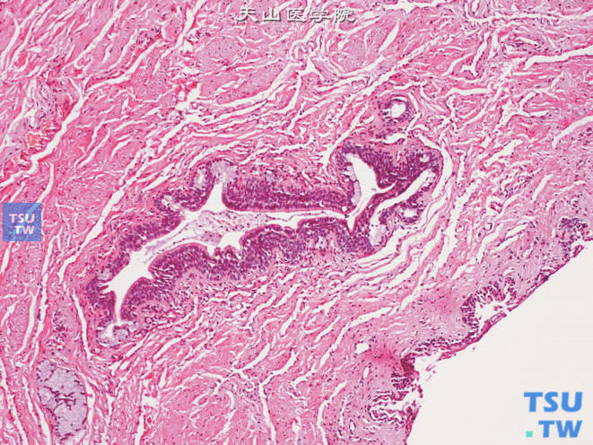 正常男性尿道。被覆尿路上皮，肌层中可见尿道腺体