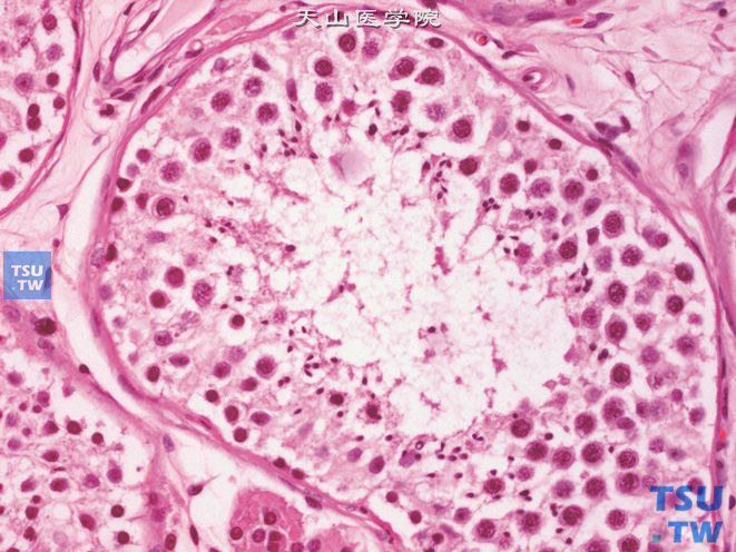 正常睾丸曲细精管内可见各级生精细胞及精子。排列规则