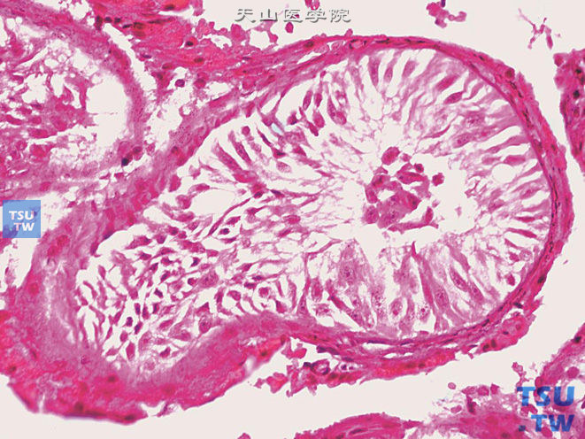 睾丸生精缺陷病理图谱