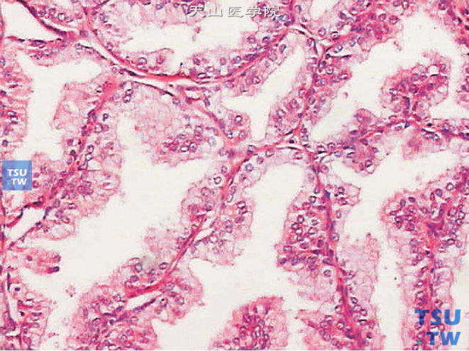 前列腺的组织学结构